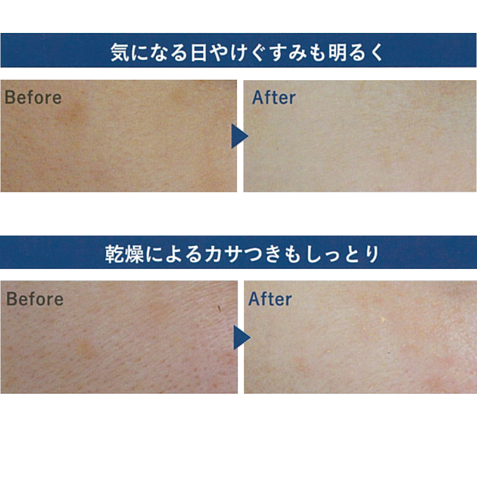 nightwhitegele_beforeafter_square2